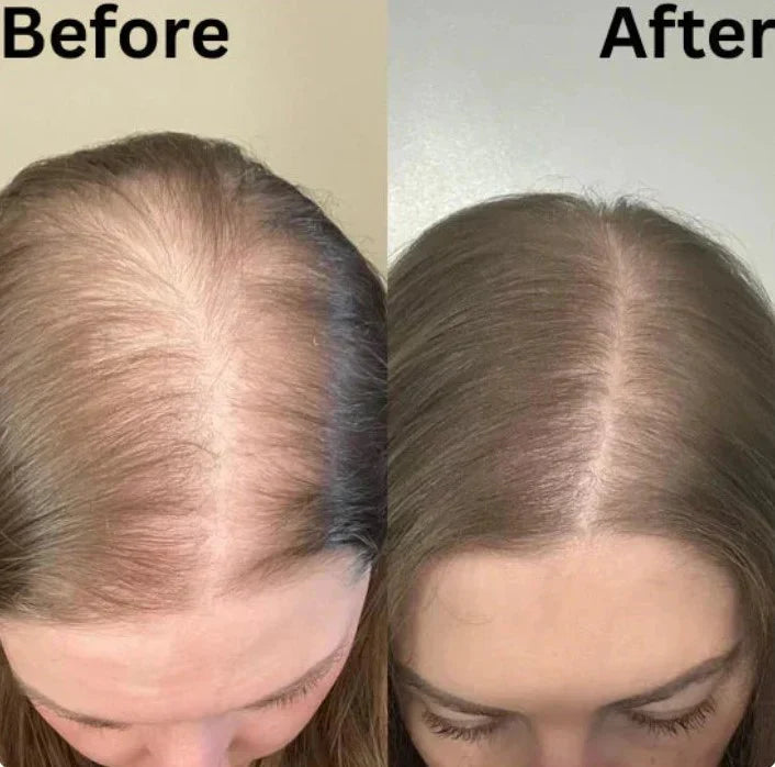 Gypsophila batana oil shampoo
