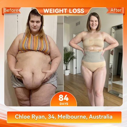 Nawaru® 𝐌𝐨𝐫𝐢𝐧𝐠𝐚 & 𝐁𝐞𝐫𝐛𝐞𝐫𝐢𝐧𝐞 4‑In‑1 Micro‑Particle Sculpting & Fat‑Burn Shorts
